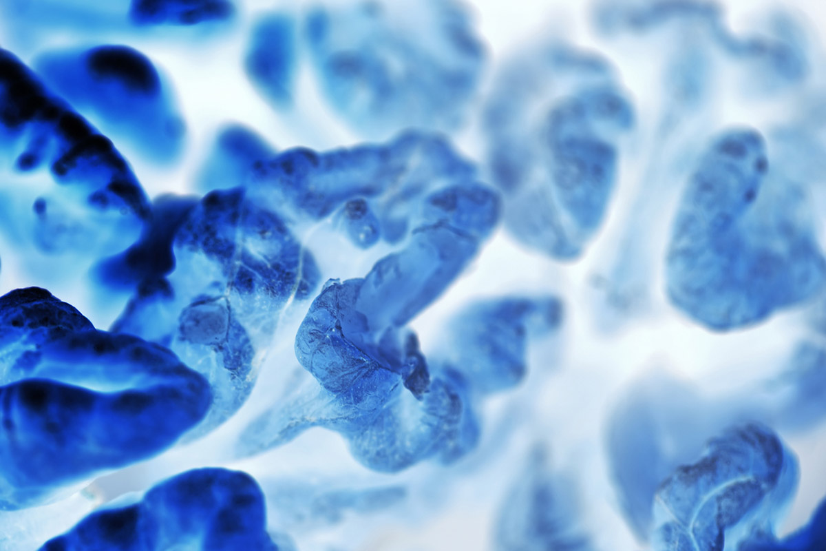 Βακτήρια και καρκίνος