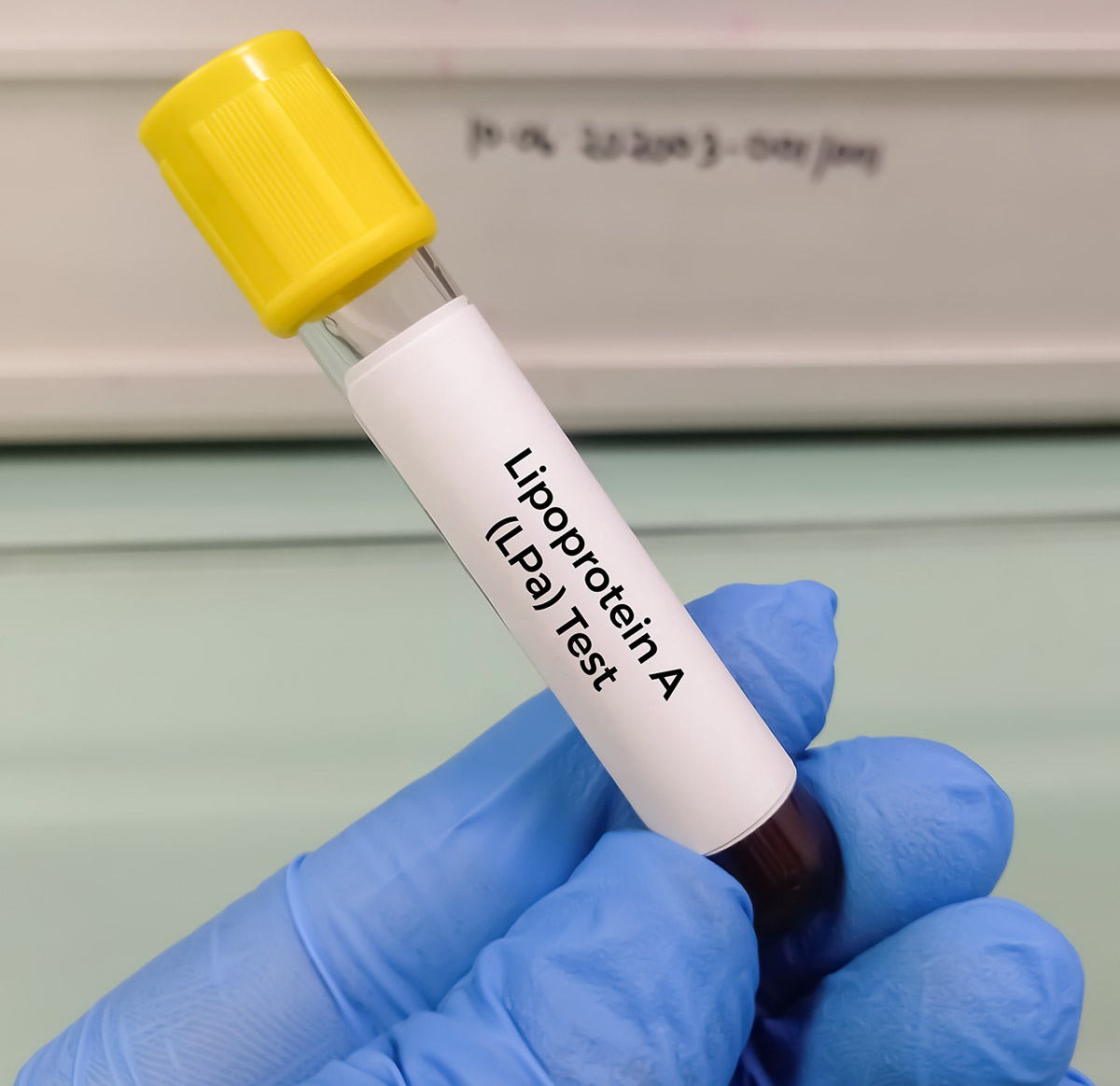 Μια νέα μέρα ξημερώνει για όσους έχουν γενετική χοληστερόλη