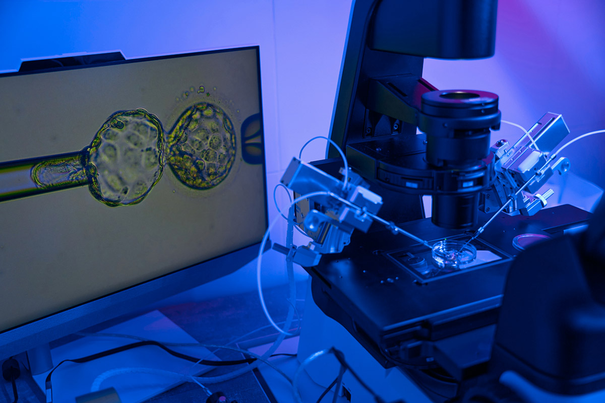 Γονιδιακός έλεγχος εμβρύων για μακροζωία: Η νέα πρακτική στην εξωσωματική γονιμοποίηση