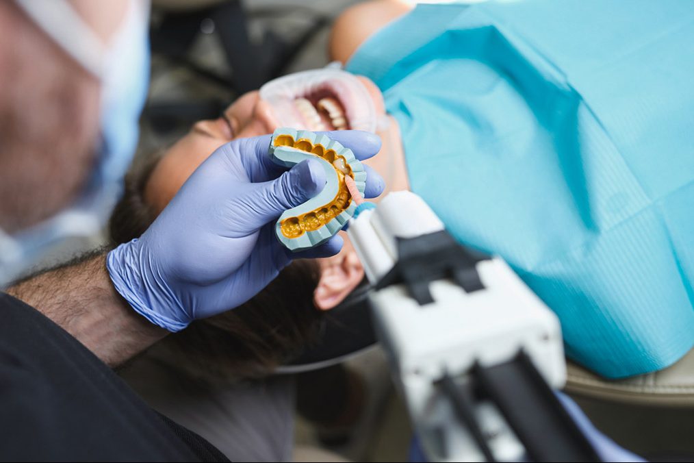 Δόντια με όψεις από ρητίνη ή πορσελάνη; Ο απόλυτος οδηγός για τέλειο χαμόγελο