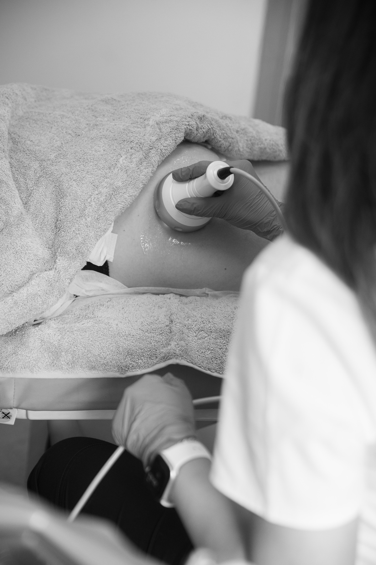 cavitation κυτταρίτιδα