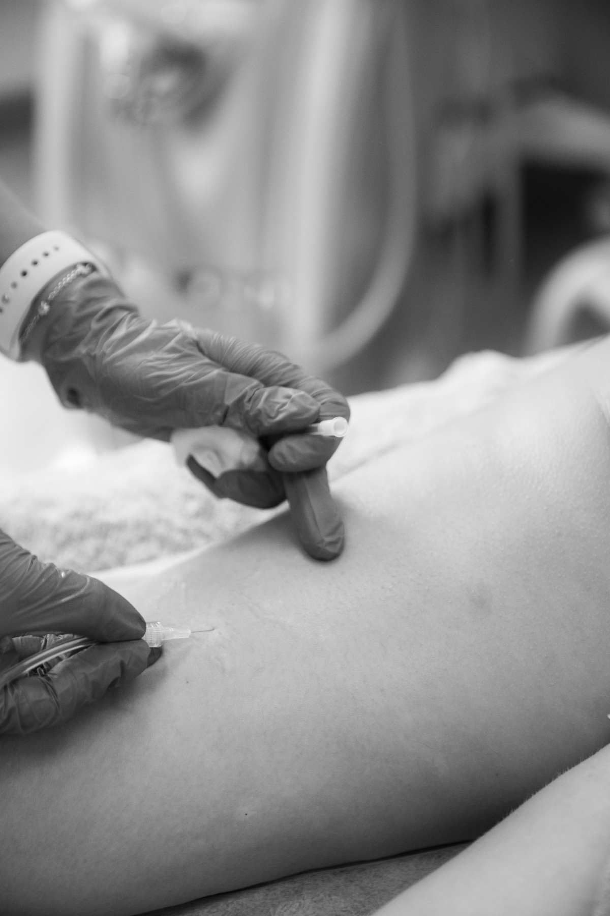 κυτταρίτιδα