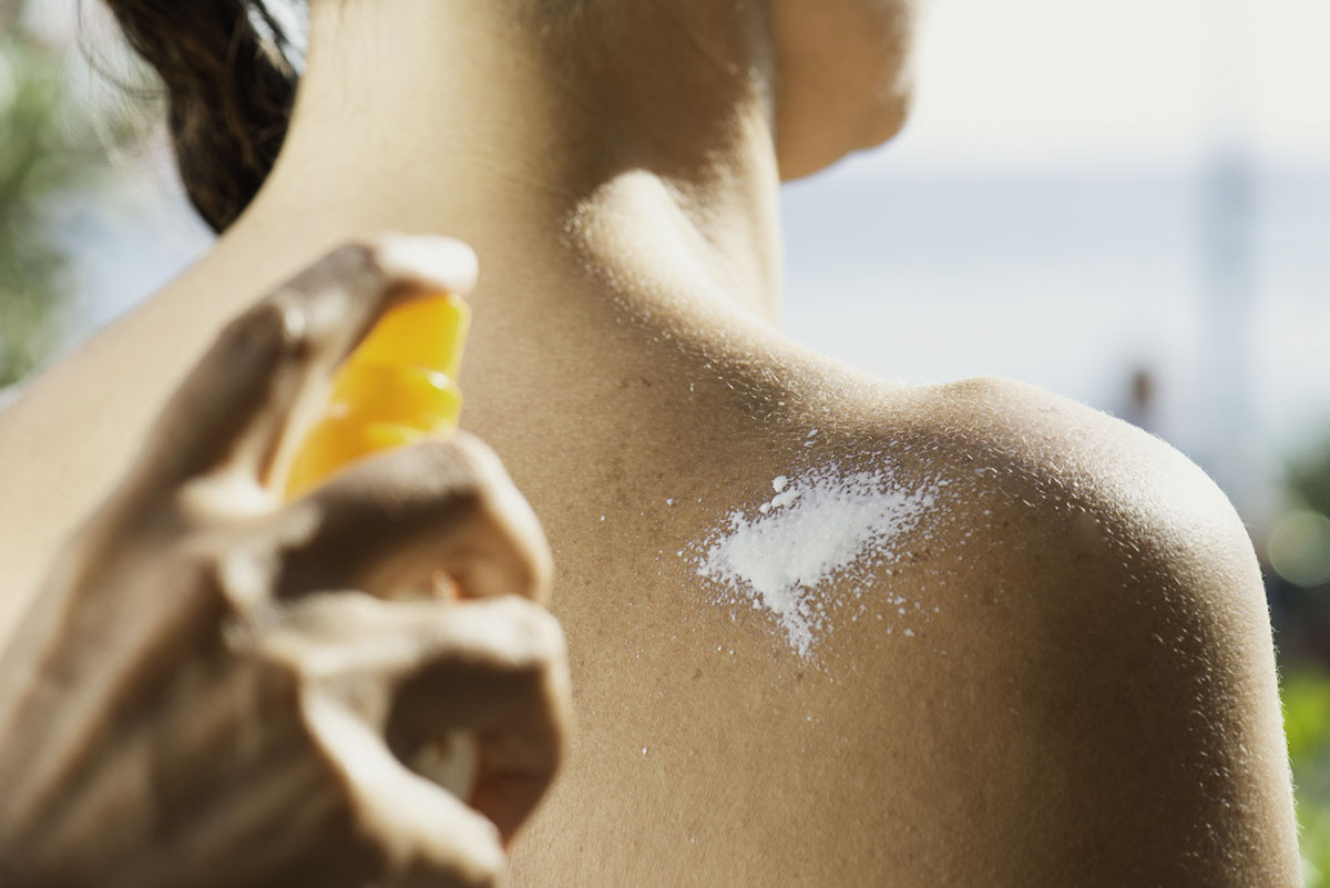 Ηλιακό έγκαυμα