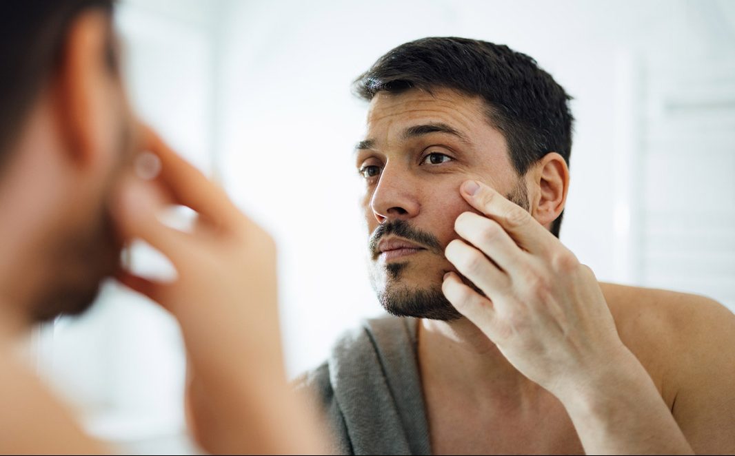 Τι μαρτυρά το πρόσωπό σου για την υγεία σου