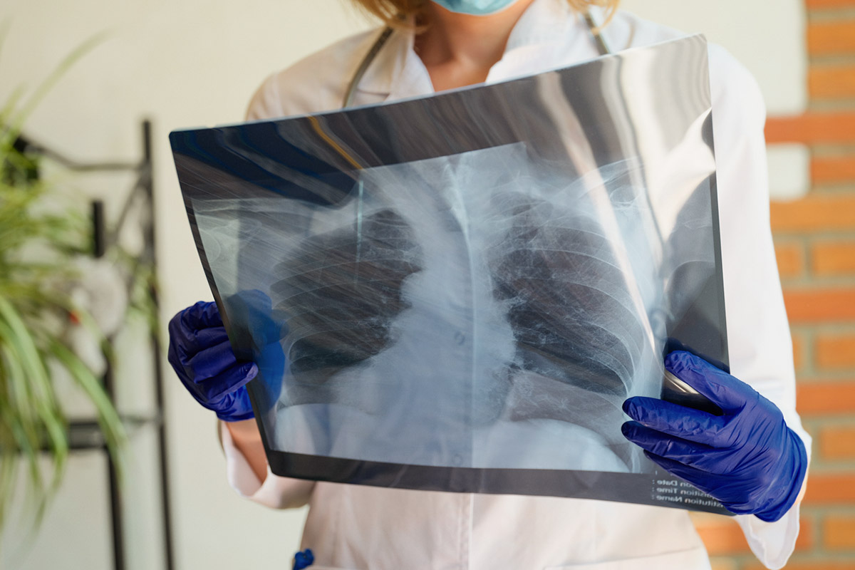 Χρόνιος βήχας