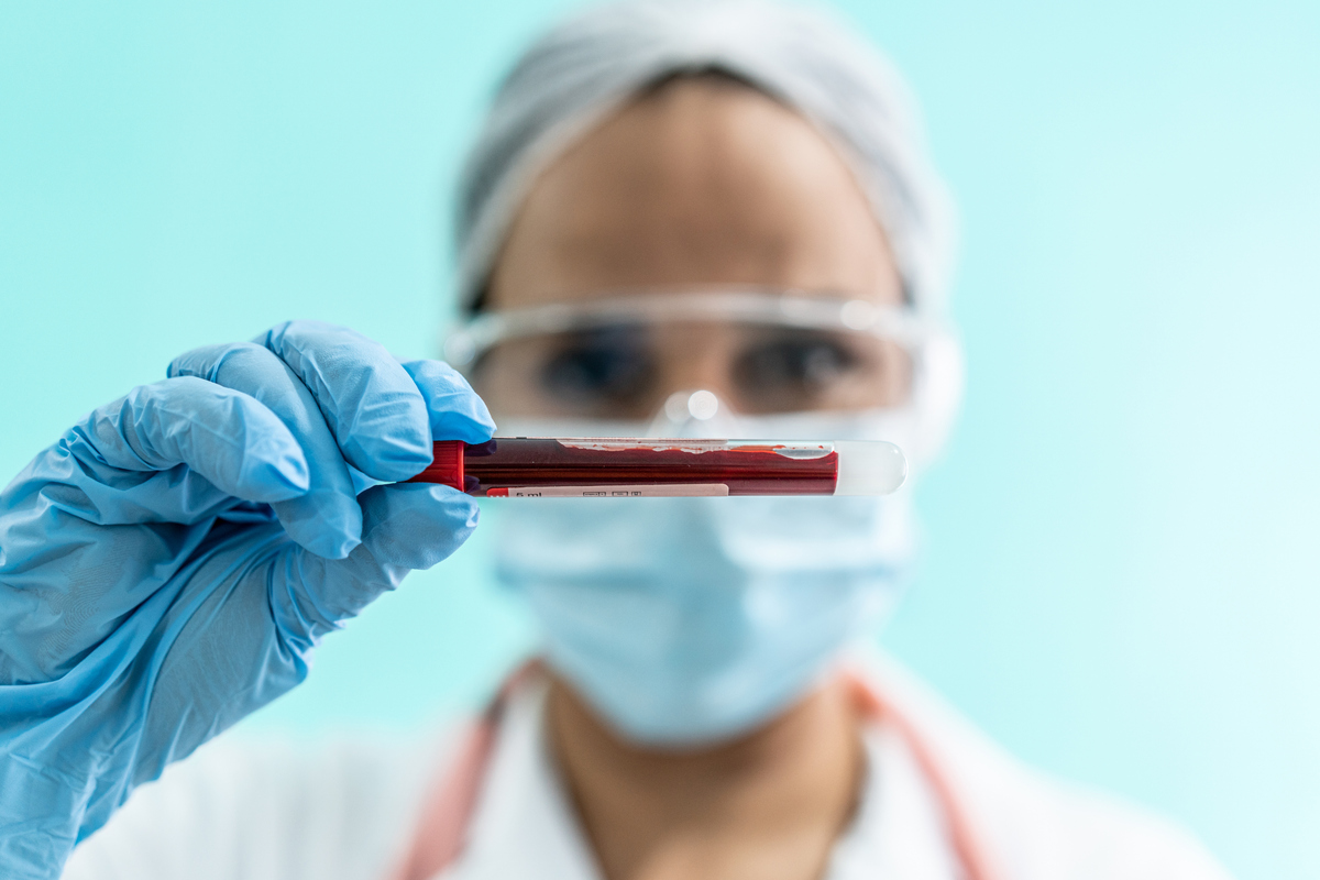 Λιποπρωτεΐνη Α