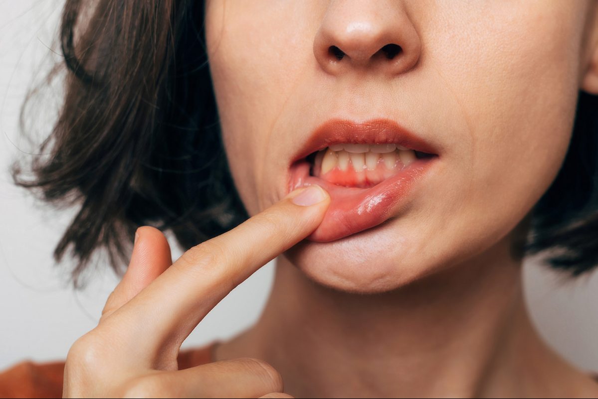 Στοματική υγεία