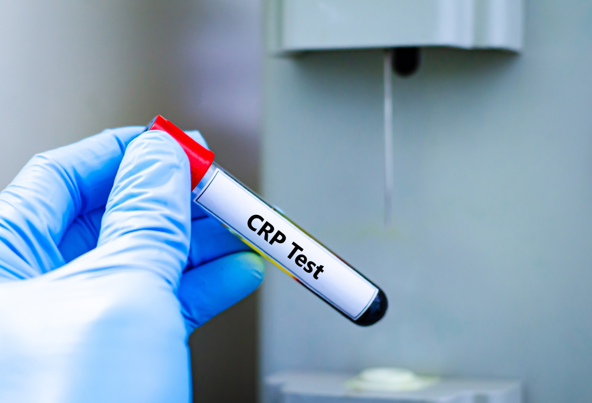 Πότε άρχισε η φλεγμονή να θέλει το κακό μας;