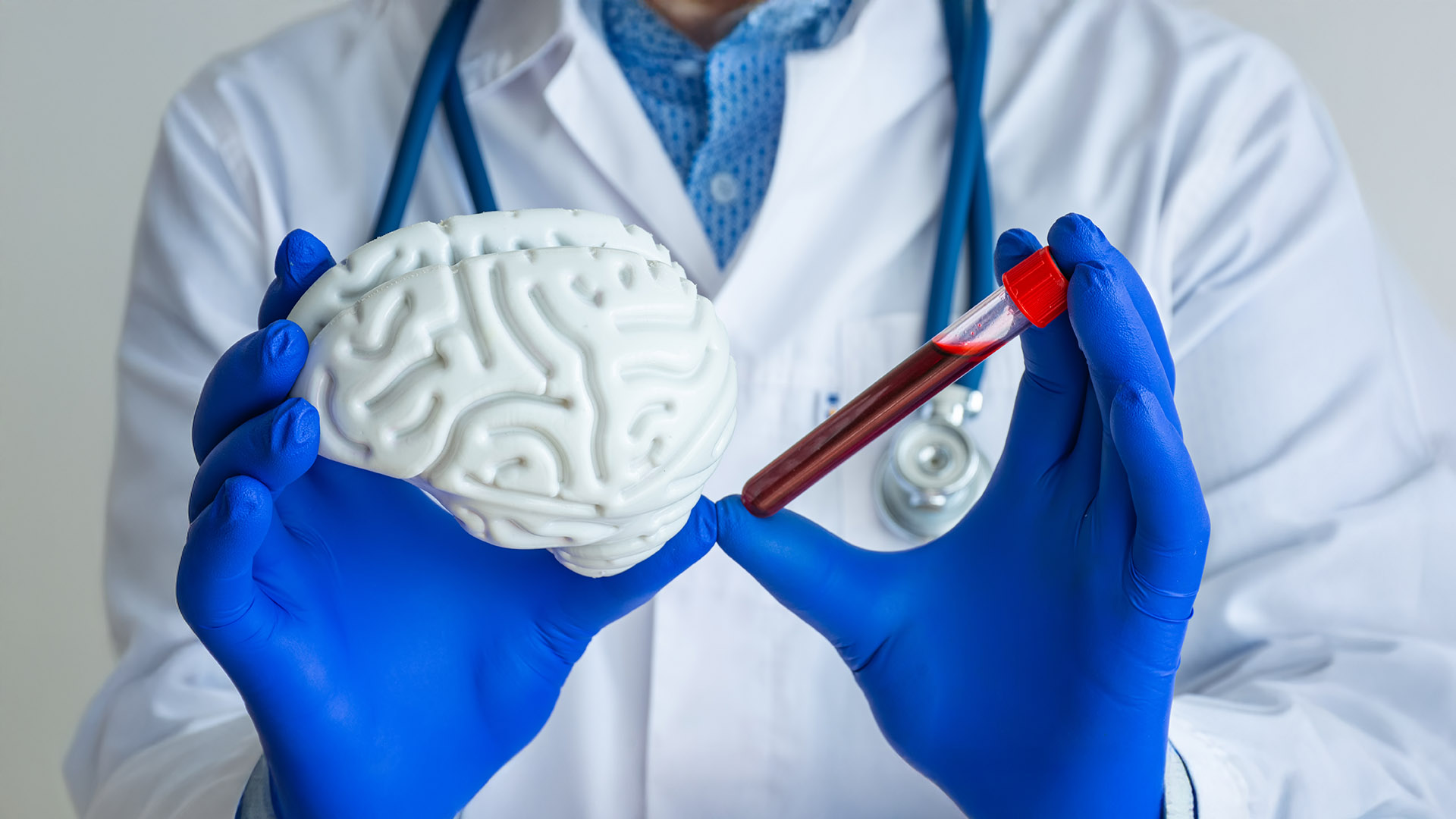 Η χρόνια φλεγμονή οδηγεί σε νόσο παρόμοια με των τρελών αγελάδων