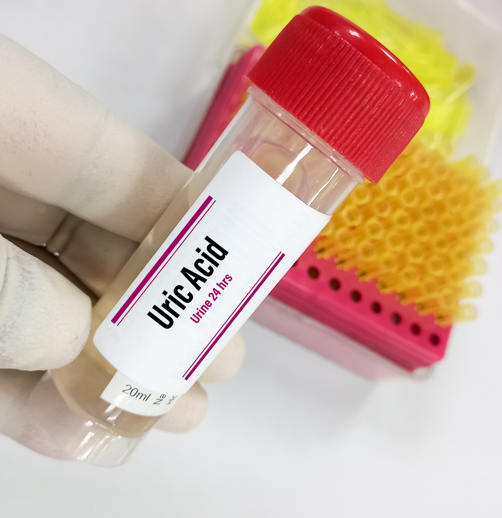 Το TiktTok βλάπτει σοβαρά τα άτομα με ουρική αρθρίτιδα