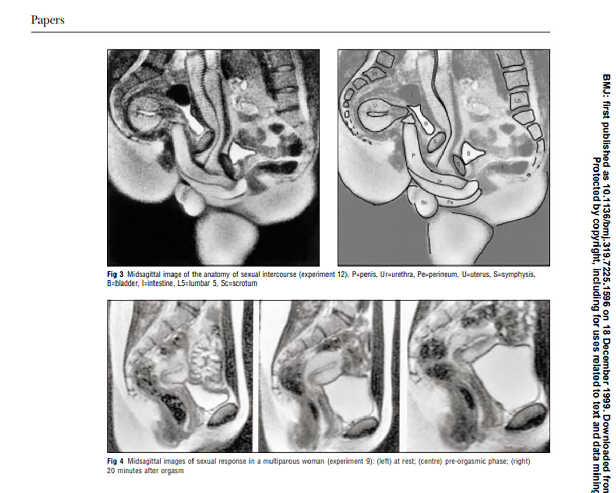 Τι συνέβη όταν ένα ζευγάρι έκανε σεξ μέσα σε μαγνητικό τομογράφο;