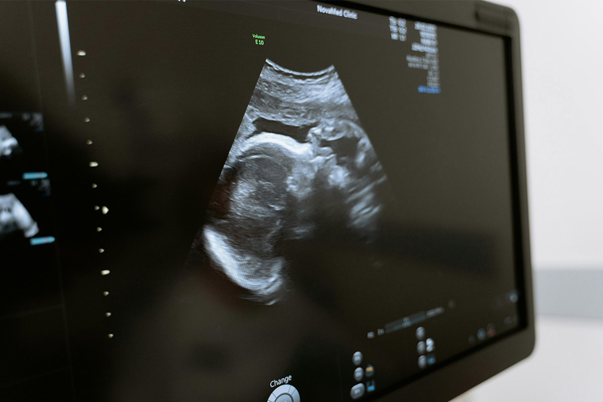 Ο κίνδυνος καρκίνου μπορεί να καθορίζεται πριν από τη γέννηση, δείχνει νέα έρευνα