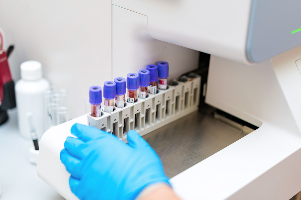 Τα δύο δώρα που κάνεις στην υγεία σου ενισχύοντας τους μυς σου