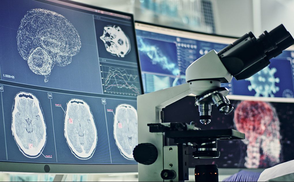 Αλτσχάιμερ και Covid-19