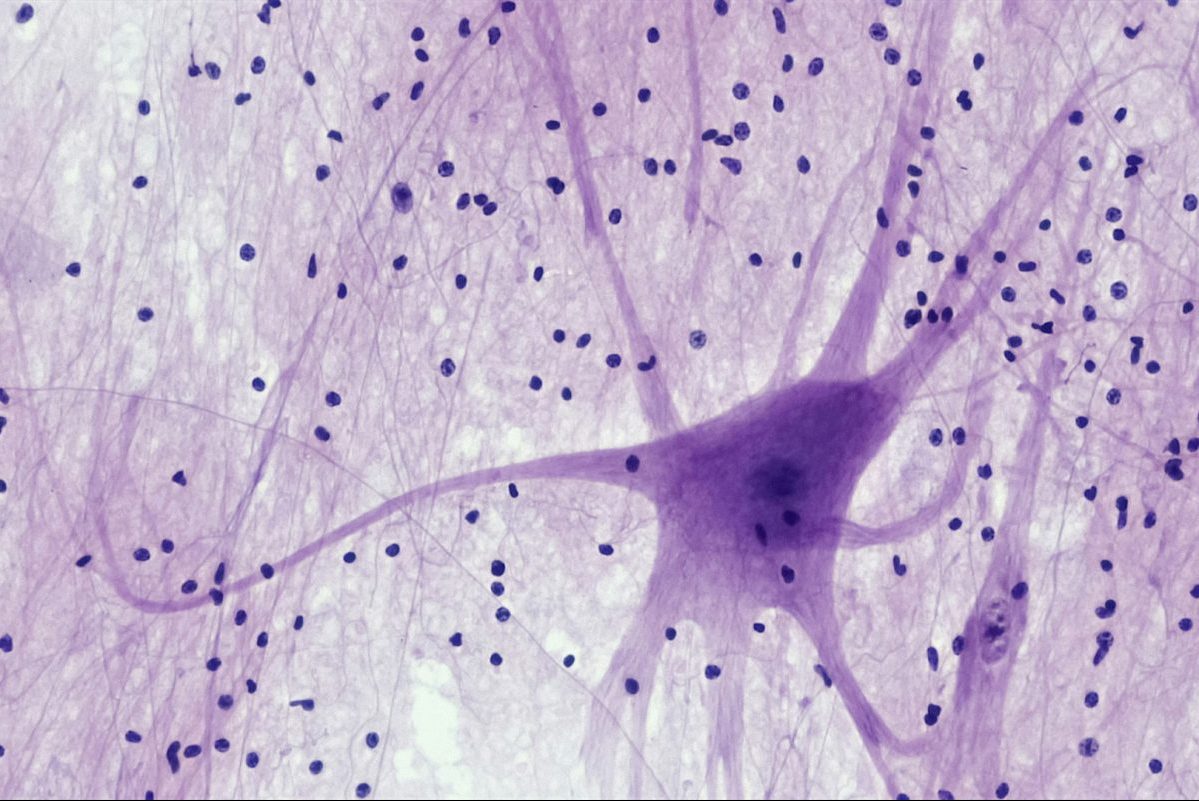 Νευρικό σύστημα 