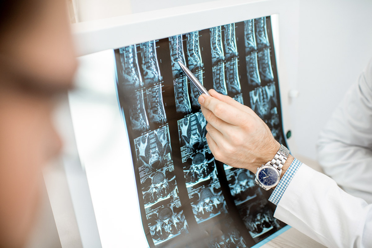 Η νο1 συνήθεια που καταστρέφει τη σπονδυλική στήλη, σύμφωνα με διάσημη νευροχειρουργό