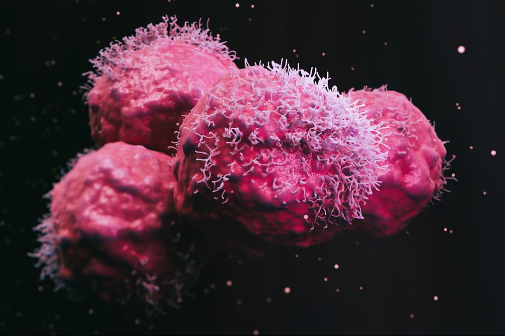 Έρχεται προληπτικό εμβόλιο για τον καρκίνο του πνεύμονα;