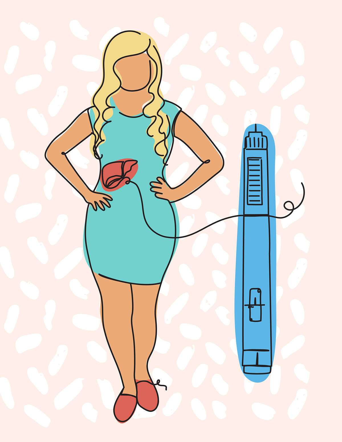 Οι αγωνιστές GLP-1 θα σώσουν το συκώτι σου (ακόμα κι αν δεν χάσεις βάρος)