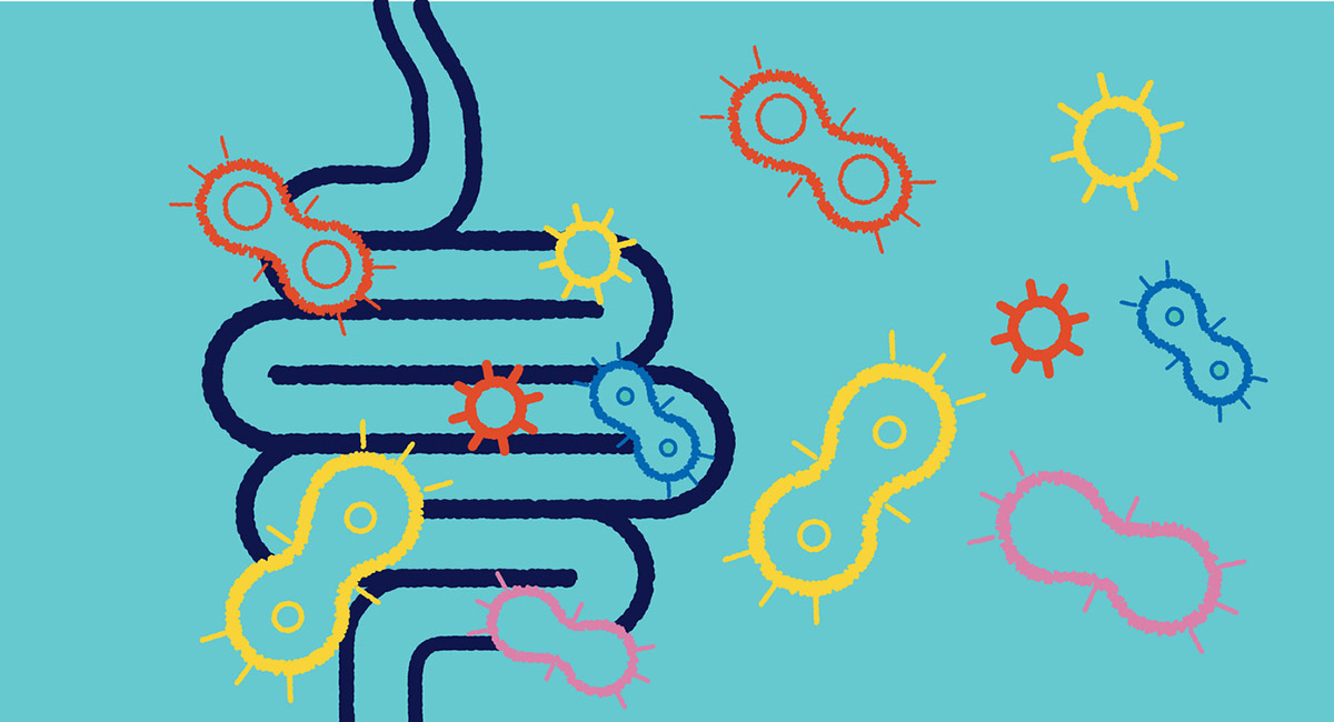 Τεστ κοπράνων και τεχνητή νοημοσύνη εντοπίζουν καρκίνους με ακρίβεια 90%