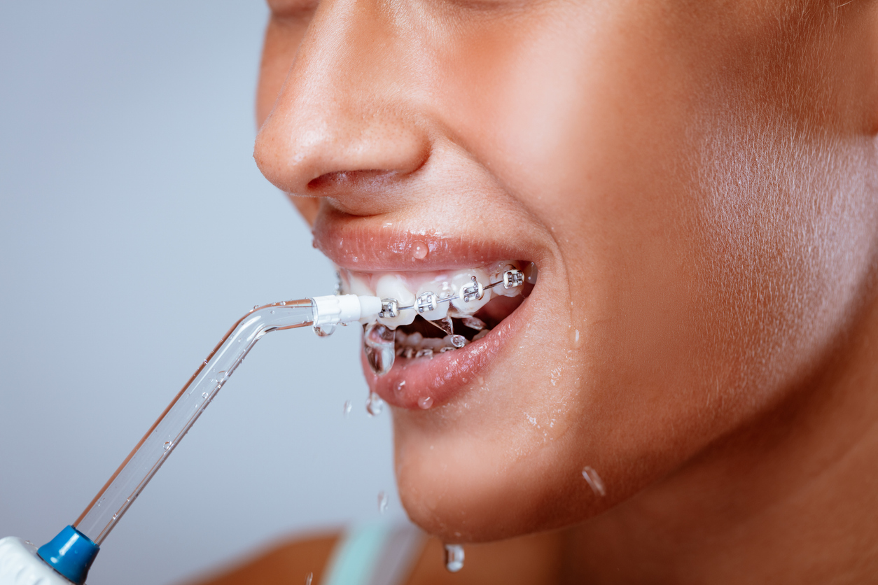 Είναι το water flosser η λύση για πιο καθαρά δόντια;