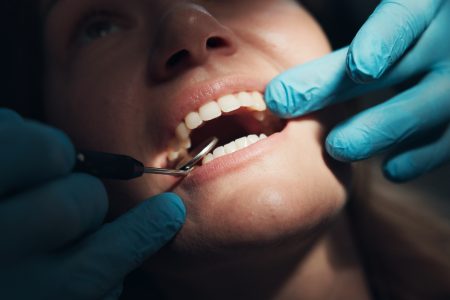 10 μύθοι και αλήθειες για την περιοδοντίτιδα